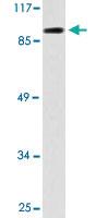 Anti-CDH16 Rabbit Polyclonal Antibody