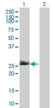 Anti-THY1 Mouse Polyclonal Antibody