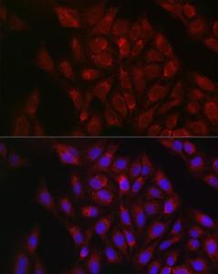 Anti-RBCK1 antibody