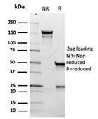 Antibody anti-CD5 RC56429 100 µg