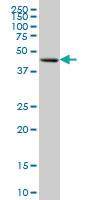 Anti-FOXA1 Mouse Monoclonal Antibody [clone: 1B1]