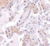 Anti-CAPN6 Rabbit Polyclonal Antibody