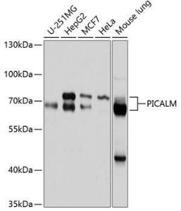 Western blot analysis of extracts of various cell lines, using Anti-PICALM Antibody (A11335) at 1:1,000 dilution