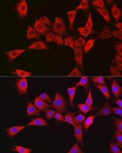 Anti-RBCK1 antibody