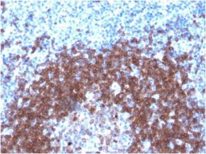 Immunohistochemical analysis of formalin-fixed, paraffin-embedded human tonsil using Anti-CD79a Antibody [IGA/1790R]