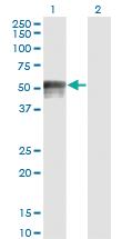 Anti-FOXA1 Mouse Monoclonal Antibody [clone: 1B1]