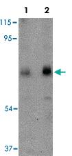 Anti-CAPN6 Rabbit Polyclonal Antibody