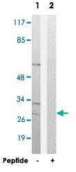 Anti-EIF3K Rabbit Polyclonal Antibody