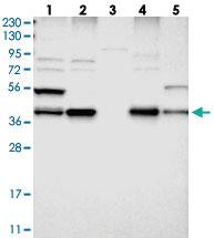 Anti-ERLIN1 Rabbit Polyclonal Antibody