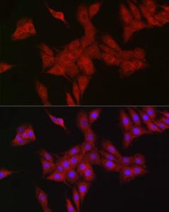 Anti-RBCK1 antibody