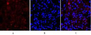 Immunofluorescence analysis of rat lung tissue using Anti-Cadherin-pan Antibody (red) at 1:200 (4 °C overnight). Cy3 labelled secondary Antibody was used at 1:300 (RT 50 min). Panel A: Target. Panel B: DAPI. Panel C: Merge