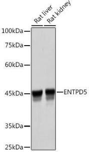 Western blot analysis of extracts of various cell lines, using Anti-ENTPD5 Antibody [ARC2211] (A305942) at 1:3,000 dilution