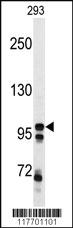 Anti-MERTK Rabbit Polyclonal Antibody