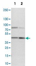 Anti-ERLIN1 Rabbit Polyclonal Antibody