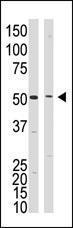 Anti-PSEN1 Rabbit Polyclonal Antibody (HRP (Horseradish Peroxidase))