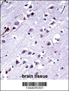 Anti-KIF16B Rabbit Polyclonal Antibody (FITC (Fluorescein Isothiocyanate))