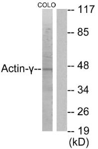 Anti-Actin-gamma2 antibody