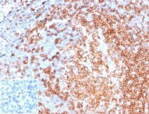 Anti-CD22 Mouse Recombinant Antibody [Clone: rBLCAM/6749]