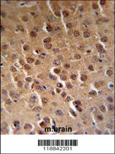 Anti-CDK14 Rabbit Polyclonal Antibody