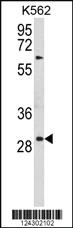 Anti-UPK1B Rabbit Polyclonal Antibody