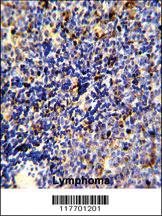 Anti-MERTK Rabbit Polyclonal Antibody