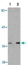 Anti-ALDH3A2 Rabbit Polyclonal Antibody