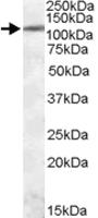 Anti-ERN1 Goat Polyclonal Antibody