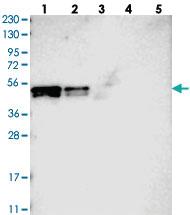 Anti-POLDIP3 Rabbit Polyclonal Antibody