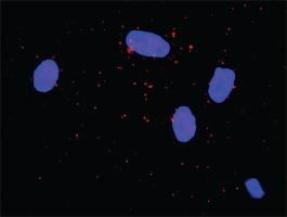 Anti-JUP + CTNNA1 Antibody Pair