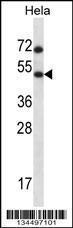 Anti-HSFX1 Rabbit Polyclonal Antibody (AP (Alkaline Phosphatase))