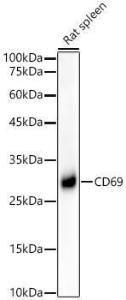 Western blot analysis of Rat spleen, using Anti-CD69 Antibody [ARC56158] (A308834) at 1:4,000 dilution