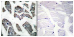 Anti-Actin-gamma2 antibody