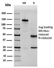 SDS-PAGE analysis of Anti-SERBP1 Antibody [SERBP1/3497] under non-reduced and reduced conditions; showing intact IgG and intact heavy and light chains, respectively. SDS-PAGE analysis confirms the integrity and purity of the Antibody