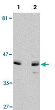 Anti-ACVR1 Rabbit Polyclonal Antibody