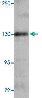 Anti-ZEB1 Rabbit Polyclonal Antibody