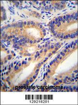 Anti-HSD11B1L Rabbit Polyclonal Antibody (Biotin)