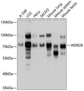 Western blot analysis of extracts of various cell lines, using Anti-WDR26 Antibody (A11342) at 1:1,000 dilution. The secondary antibody was Goat Anti-Rabbit IgG H&L Antibody (HRP) at 1:10,000 dilution.