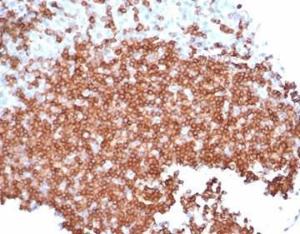 Anti-CD22 Mouse Recombinant Antibody [Clone: rBLCAM/6749]