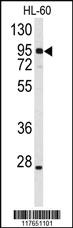 Anti-TMC6 Rabbit Polyclonal Antibody