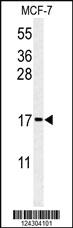 Anti-RPS24 Rabbit Polyclonal Antibody