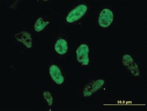 Anti-SP1 Mouse Monoclonal Antibody [clone: 4H6]