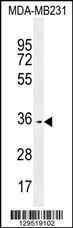 Anti-OR10Z1 Rabbit Polyclonal Antibody (AP (Alkaline Phosphatase))