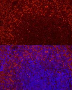 Immunofluorescence analysis of rat spleen using Anti-CD69 Antibody [ARC56158] (A308834) at a dilution of 1:200(40X lens). DAPI was used to stain the cell nuclei (blue)