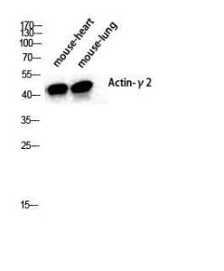 Anti-Actin-gamma2 antibody