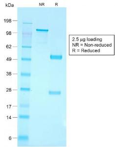 SDS-PAGE analysis of Anti-CD79a Antibody [IGA/1790R] under non-reduced and reduced conditions; showing intact IgG and intact heavy and light chains, respectively. SDS-PAGE analysis confirms the integrity and purity of the antibody.