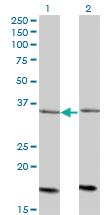 Anti-ADCK4 Mouse Monoclonal Antibody [clone: 1D9]