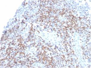 Immunohistochemical analysis of formalin-fixed, paraffin-embedded human tonsil using Anti-ZAP70 Antibody [ZAP70/3921R]