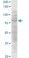 Anti-CTNNAL1 Mouse Monoclonal Antibody [clone: 3C8]