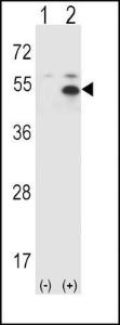 Anti-STAM Rabbit Polyclonal Antibody (HRP (Horseradish Peroxidase))