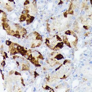 Immunohistochemistry analysis of paraffin-embedded rat kidney using Anti-Alpha B Crystallin Antibody [ARC1672] (A308835) at a dilution of 1:100 (40X lens). Perform microwave antigen retrieval with 10 mM Tris/EDTA buffer pH 9.0 before commencing with IHC staining protocol